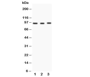 Western blot testing of FER antibody and Lane 1: HeLa; 2: rat testis; 3: rat ovary. Predicted/observed molecular weight: ~95 kDa.