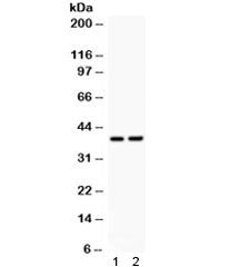 Western blot testing of 1) rat brain and 2 mouse NIH3T3 lysate with SOX1 antibody. Predicted/observed molecular weight ~39 kDa.