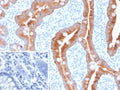 IHC staining of FFPE human colon tissue with recombinant CK8/18 antibody (KRT8.18/6579R). Inset: PBS used in place of primary Ab (secondary Ab negative control). HIER: boil tissue sections in pH 9 10mM Tris with 1mM EDTA for 20 min and allow to cool before testing.