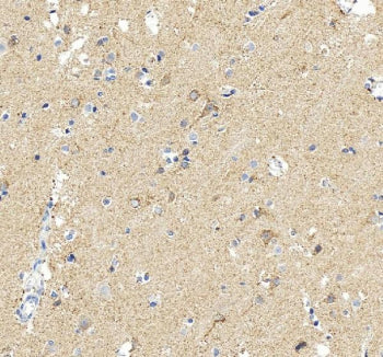 IHC staining of FFPE human brain tissue with MAOB antibody, HRP-secondary and DAB substrate. HIER: boil tissue sections in pH8 EDTA for 20 min and allow to cool before testing.