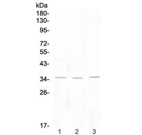 Western blot testing of 1) rat lymph, 2) rat spleen and 3) mouse thymus tissue lysate with NKG2D antibody at 0.5ug/ml. Predicted molecular weight ~25 kDa (unmodified), ~35 kDa (glycosylated).