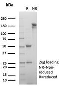 SDS-PAGE analysis of purified, BSA-free Alpha-2-Macroglobulin antibody (clone A2M/6554) as confirmation of integrity and purity.