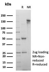 SDS-PAGE analysis of purified, BSA-free Alpha-2-Macroglobulin antibody (clone A2M/6554) as confirmation of integrity and purity.