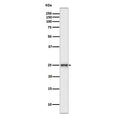 Western blot testing of human SH-SY5Y cell lysate with PGP9.5 antibody. Predicted molecular weight ~25 kDa.
