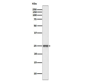 Western blot testing of human SH-SY5Y cell lysate with PGP9.5 antibody. Predicted molecular weight ~25 kDa.