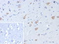 IHC staining of FFPE human brain tissue with recombinant NeuN antibody (clone rNEUN/8055). Inset: PBS used in place of primary Ab (secondary Ab negative control). HIER: boil tissue sections in pH 9 10mM Tris with 1mM EDTA for 20 min and allow to cool before testing.