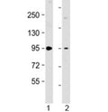 Western blot testing of 1) human brain lysate and 2) mouse NIH3T3 cell lysate with PKD2 antibody at 1:2000. Predicted molecular weight: 97 kDa.