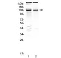 Western blot testing of 1) rat brain and 2) mouse brain tissue lysate with BMPR2 antibody at 0.5ug/ml. Predicted molecular weight ~115 kDa.