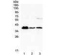 Western blot testing of human 1) T-47D, 2) U937 and 3) A431 cell lysate with MR1 antibody at 0.5ug/ml. Predicted molecular weight ~39 kDa.