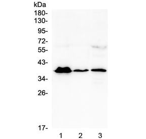 Western blot testing of human 1) T-47D, 2) U937 and 3) A431 cell lysate with MR1 antibody at 0.5ug/ml. Predicted molecular weight ~39 kDa.