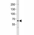 Western blot analysis of lysate from SK-N-MC cell line using PCSK9 antibody at 1:1000. Predicted size: Pro/mature ~74/64 kDa