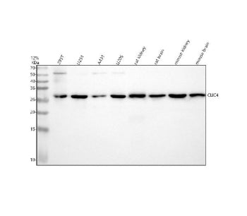 Western blot analysis of CLIC4 using anti-CLIC4 antibody. Lane 1: human 293T whole cell lysates, Lane 2: human U251 whole cell lysates, Lane 3: human whole cell lysates, Lane 4: human U20S whole cell lysates, Lane 5: rat kidney tissue lysates, Lane 6: rat brain tissue lysates, Lane 7: mouse kidney tissue lysates, Lane 8: mouse brain tissue lysates. After electrophoresis, proteins were transferred to a nitrocellulose membrane at 150 mA for 50-90 min.