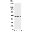 Western blot testing of ATF4 antibody and Lane 1: A431; 2: Raji; 3: CEM; 4: HUT cell lysate. Predicted molecular weight ~39kDa.