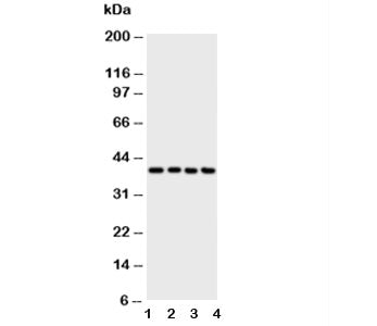 Western blot testing of ATF4 antibody and Lane 1: A431; 2: Raji; 3: CEM; 4: HUT cell lysate. Predicted molecular weight ~39kDa.