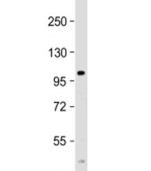 Western blot testing of human spleen lysate with PARP10 antibody at 1:2000. Predicted molecular weight: 110 kDa.