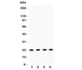 Western blot testing of Securin antibody and Lane 1: HeLa; 2: MCF-7; 3: SKOV; 4: A375 lysate. Predicted molecular weight ~22 kDa, can be observed at 25-30 kDa.