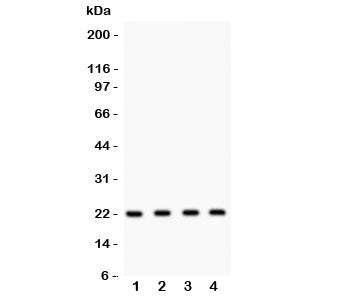 Western blot testing of Securin antibody and Lane 1: HeLa; 2: MCF-7; 3: SKOV; 4: A375 lysate. Predicted molecular weight ~22 kDa, can be observed at 25-30 kDa.