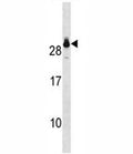 GSTT2 antibody western blot analysis in A549 lysate.