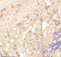 IHC staining of FFPE zebrafish brain tissue with Psmd6 antibody, HRP-labeled secondary and DAB substrate. HIER: boil tissue sections in pH8 EDTA for 20 min and allow to cool before testing.
