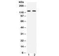 Western blot testing of mouse 1) brain and 2) HEPA lysate with mouse CD11b antibody at 0.5ug/ml. Expected molecular weight: 127~170 kDa due to glycosylation.