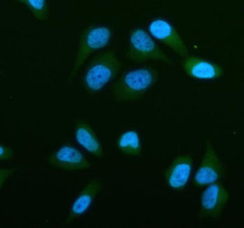 Immunofluorescent staining of STRN3 using anti-STRN3 antibody (green). STRN3 was detected in an immunocytochemical section of human HELA cells. Enzyme antigen retrieval was performed using IHC enzyme antigen retrieval reagent for 15 mins. The cells were blocked with 10% goat serum. And then incubated with 5 ug/ml rabbit anti-STRN3 antibody overnight at 4oC. DyLight 488 Conjugated Goat Anti-Rabbit IgG was used as secondary antibody at 1:500 dilution and incubated for 30 min at 37oC.