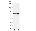 Western blot testing of CD14 antibody and Lane 1: mouse thymus; 2: mouse spleen tissue lysate