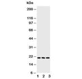 Western blot testing of FGF21 antibody and Lane 1: human A549; 2: human A431; 3: mouse HEPA cell lysate. Predicted molecular weight ~21 kDa.