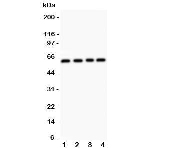Western blot testing of RUNX2 antibody and Lane 1: HeLa; 2: A431; 3: K562; 4: Jurkat. Predicted molecular weight: 50-60 kDa.