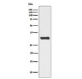 Western blot testing of lysate from human HeLa cells treated with Calyculin A, with phospho-RPA32 antibody (pT21). Predicted molecular weight ~32 kDa.