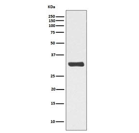 Western blot testing of lysate from human HeLa cells treated with Calyculin A, with phospho-RPA32 antibody (pT21). Predicted molecular weight ~32 kDa.
