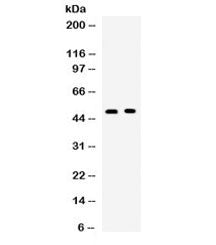 Western blot testing of human 1) SW620 and 2) 22RV1 cell lysate with OX40 antibody. Expected molecular weight: 29-50 kDa depending on glcyosylation level.