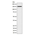 Western blot testing of human HeLa cell lysate with Vigilin antibody. Predicted molecular weight ~141 kDa.