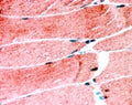 IHC testing of FFPE human skeletal muscle with MURF1 antibody at 1.25ug/ml. HIER: steamed with pH6 citrate buffer, AP-staining.