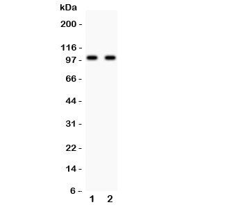 Western blot testing of Glutamate receptor 3 antibody and Lane 1: rat brain; 2: mouse brain lysate. Predicted/observed size ~99KD