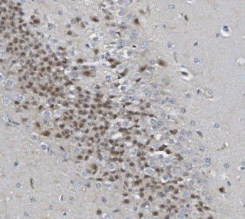 IHC staining of FFPE rat brain with Rad9b antibody. HIER: boil tissue sections in pH8 EDTA for 20 min and allow to cool before testing.