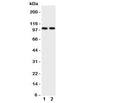 Western blot testing of ZO-3 antibody and Lane 1: rat brain; 2: rat heart tissue lysate. Predicted/observed size ~103KD