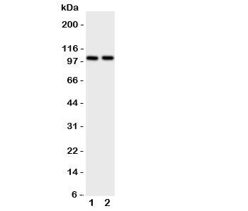 Western blot testing of ZO-3 antibody and Lane 1: rat brain; 2: rat heart tissue lysate. Predicted/observed size ~103KD