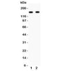 Western blot testing of NR2A antibody and Lane 1: rat brain; 2: mouse brain lysate. Predicted/observed size ~165KD
