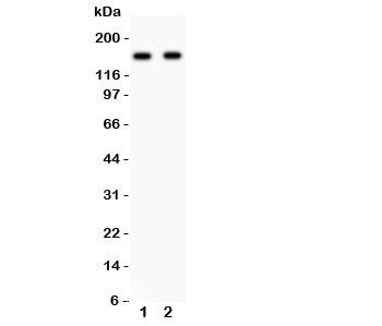 Western blot testing of NR2A antibody and Lane 1: rat brain; 2: mouse brain lysate. Predicted/observed size ~165KD