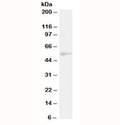 Western blot testing of human Daudi lysate with NFIL3 antibody at 2ug/ml. Predicted molecular weight: ~52 kDa.