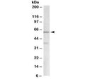 Western blot testing of human cerebellum lysate with VGLUT2 antibody at 2ug/ml. Molecular weight: the expected ~60 kDa band and the additional ~37 kDa band are both blocked by the immunizing peptide.