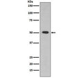 Western blot testing of human HepG2 cell lysate with ALDH1A1 antibody. Predicted molecular weight ~55 kDa.