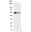 Western blot testing of IL-23 antibody and Lane 1: recombinant mouse protein 10ng; 2: 5ng; 3: 2.5ng (p40 + p19)