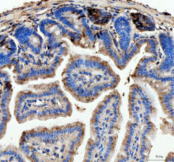 IHC analysis of Lysozyme using anti-Lysozyme antibody. Lysozyme was detected in a paraffin-embedded section of mouse colon tissue. Heat mediated antigen retrieval was performed in EDTA buffer (pH 8.0, epitope retrieval solution). The tissue section was blocked with 10% goat serum. The tissue section was then incubated with 2 ug/ml rabbit anti-Lysozyme antibody overnight at 4oC. Peroxidase Conjugated Goat Anti-rabbit IgG was used as secondary antibody and incubated for 30 min at 37oC.