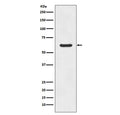 Western blot testing of human K562 cell lysate with Asparagine Synthetase antibody. Predicted molecular weight ~64 kDa.