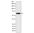Western blot analysis of HRPT2/CDC73 expression in 293T cell lysate using CDC73 antibody. Predicted molecular weight ~61 kDa.