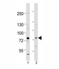 Western blot testing of Melk antibody at 1:1000 dilution. Lane 1: mouse spleen lysate; 2: mouse thymus lysate; Predicted molecular weight ~ 73 kDa.