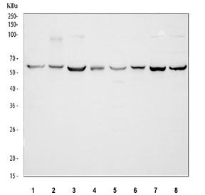 Western blot testing of 1) rat brain, 2) rat spleen, 3) rat C6, 4) rat PC-12, 5) mouse brain, 6) mouse spleen, 7) mouse NIH 3T3 and 8) mouse RAW264.7 cell lysate with TCP1 beta antibody. Predicted molecular weight ~57 kDa.