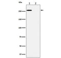 Western blot testing of lysate from A431 cells 1) untreated and 2) treated with lambda phosphatase, with Phospho-ACACA antibody.