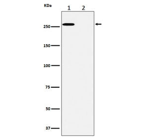 Western blot testing of lysate from A431 cells 1) untreated and 2) treated with lambda phosphatase, with Phospho-ACACA antibody.